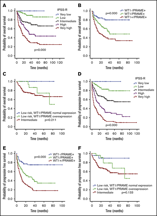 OS and PFS of patients with MDS according to IPSS-R and WT1 and PRAME transcript levels. Patients with MDS were grouped according to favorable (low WT1 or low PRAME) or adverse (high WT1 or high PRAME) expression profiles. Therefore, the proposed score was drawn up by assigning a value of 0 for each gene expressing a favorable RNA level and a value of 1 for each gene with an adverse expression profile. OS (A) and PFS (D) of patients with MDS based on IPSS-R. OS (B) and PFS (E) of patients with MDS based on WT1/PRAME score. It distinguished 3 subsets of patients with different OS (P < .001) and PFS (P < .001). The OS and PFS for patients with both WT1 and PRAME overexpression were significantly lower than that those for patients with either WT1 or PRAME overexpression (P = .013 for OS; P = .001 for PFS, respectively). OS (C) and PFS (F) of patients with MDS in the next-highest IPSS risk group is included for the purpose of comparison, P values were calculated between low-risk patients with WT1/PRAME overexpression and intermediate patients.
