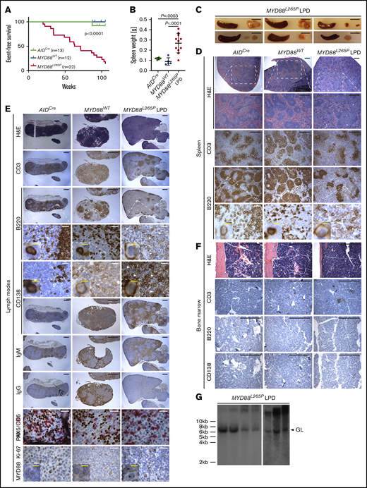 Development of a non-clonal, low-grade B-cell LPD in MYD88L265Pmice. (A) Kaplan-Meier plots illustrating event-free survival of aging cohorts of AIDCre (n = 13), MYD88WT (n = 12), and MYD88L265P (n = 28) mice. P value was calculated by using a log-rank test. (B) Spleen weights in aged AIDCre (n = 5) and MYD88WT (n = 5) control mice and MYD88L265P (n = 11) mice with LPD. Graphs depict the mean ± SD. P values were calculated by using Welch’s t test. (C) Gross images of spleens and LNs from representative MYD88L265P mice with low-grade B-cell LPD. Scale bar, 1 cm. Histologic and IHC stains of indicated markers on serial spleen (D), LN (E), and BM (F) sections from representative, age-matched AIDCre and MYD88WT control mice, and 1 MYD88L265P mouse with LPD. Note expansion of plasmacytoid lymphocytes (white arrowheads) in the MYD88L265P mice compared with controls; and punctate, cytoplasmic MYD88 staining in the MYD88L265P LPD cells (black arrowheads). Scale bars: white, 50 µm; black, 500 µm; yellow, 5 µm (see also supplemental Figure 2B). (G) Clonality evaluated by Southern blot analysis of the IgH gene in DNA isolated from LNs of MYD88L265P (n = 7) mice with LPD. GL, non-rearranged germline band.