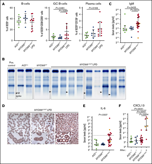 LPL/WM features of LPD in MYD88L265Pmice. (A) Flow cytometric analysis of lymphocyte subpopulations in LNs from aged AIDCre (n = 7) and MYD88WT (n = 7) control mice and MYD88L265P (n = 11) mice with LPD. Graphs depict the mean ± SD. P values were calculated by using Welch’s t test. (B) Serum protein electrophoresis of aged AIDCre (n = 2) and MYD88WT (n = 2) control mice and of MYD88L265P (n = 9) mice with LPD. Note increased abundance of diffuse gamma globulins (black arrowheads) in MYD88L265P mice compared with controls. A positive (Pos.) control containing a sharp band of gamma globulins (M spike) is shown for comparison. (C) Serum IgM concentrations assessed using multiplex immunoassay in aged AIDCre (n = 7), MYD88WT (n = 7), and MYD88L265P (n = 23) mice. Orange points represent DLBCL animals in the MYD88L265P cohort. Graphs depict the median ± 25th to 75th percentile. P values were calculated by using the Mann-Whitney U test (see also supplemental Figure 2C). (D) Peripheral blood smears demonstrating rouleaux formation of red blood cells in representative MYD88L265P (n = 3) mice with LPD. (E) Serum IL-6 concentrations assessed by multiplex immunoassay in aged AIDCre (n = 8), MYD88WT (n = 8), and MYD88L265P (n = 24) mice. Orange points represent DLBCL animals in the MYD88L265P cohort; the dotted line indicates the assay sensitivity threshold. Graphs depict the median ± 25th to 75th percentile. P value was calculated by using Fisher’s exact test. P value for the analysis with DLBCL samples omitted is .0491. (F) Serum CXCL13 concentrations assessed by multiplex immunoassay in aged AIDCre (n = 7), MYD88WT (n = 6), and MYD88L265P mice with (n = 7) or without (n = 15) macroscopic liver and/or lung changes. Orange points represent DLBCL animals in the MYD88L265P cohort. Graphs depict the median ± 25th to 75th percentile. P values were calculated by using the Mann-Whitney U test. P values for the analysis with DLBCL samples omitted are .0424, .0381, and .0139 for comparison of MYD88L265P mice with macroscopic liver and/or lung changes with AIDCre, MYD88WT, and MYD88L265P mice without macroscopic liver and/or lung changes, respectively (see also supplemental Figure 2A). Alter., alterations.