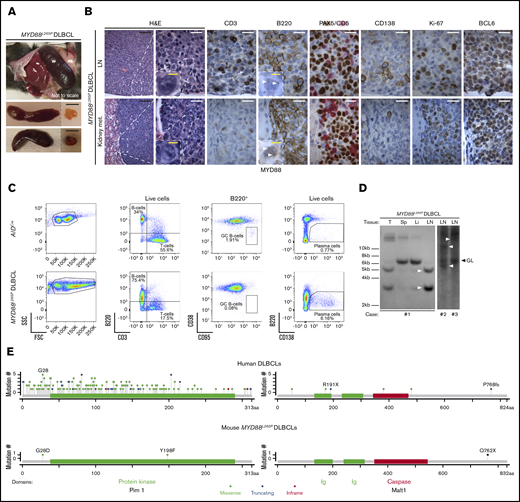 Development of DLBCL in MYD88L265Pmice. (A) Gross pathology images of spleens (top, in situ; bottom, dissected) and LNs from MYD88L265P mice with DLBCL. Scale bars, 1 cm. (B) Histologic and IHC stains of indicated markers on serial LN (top) and kidney metastasis (met.) (bottom) sections from MYD88L265P mice (n = 2) with DLBCL. Note punctate cytoplasmic MYD88 staining in the lymphoma cells (white arrowheads). Scale bars: white, 20 µm; black, 100 µm; yellow, 5 µm. (C) Density plots of flow cytometric analysis of indicated lymphocyte subpopulations in LNs from representative, age-matched AIDCre control and MYD88L265P DLBCL mice. (D) Clonality evaluated by Southern blot analysis of the IgH gene in DNA isolated from LNs, spleen (Sp), liver (Li), and tumor (T) of MYD88L265P (n = 3) mice with DLBCL. Clonal rearranged bands are indicated with white arrowheads. (E) Location of murine MYD88L265P and corresponding human DLBCL6 somatic mutations in affected proteins.