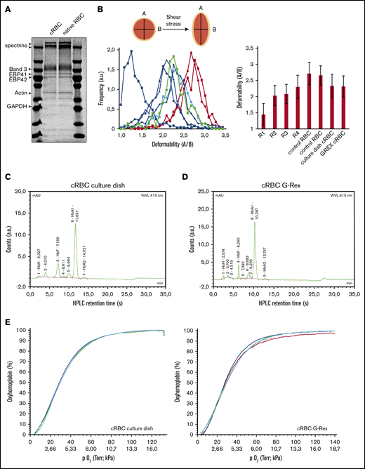 cRBC are highly similar to donor RBC. (A) Ghosts from cRBC and peripheral blood RBC were lysed and subjected to sodium dodecyl sulfate-polyacrylamide gel electrophoresis. Gel was stained with Coomassie and depicts the most abundant proteins in RBC membranes. (B) Deformability of cRBC was measured under shear stress by the Automated Rheoscope and Cell Analyzer, which elongates cells and measures length over width as deformability parameter. Progressively maturating reticulocytes were isolated from peripheral blood (in order of maturation: R1, RNAhighCD71high; R2, blue squares; RNAhighCD71low, R3, blue circles; RNAhighCD71−, blue triangles; R4: RNAlowCD71−, blue diamonds; as described previously24) were compared with fully mature RBC (red curves) and filtered cRBC from normal culture dishes (thick green line) or the G-Rex bioreactor (thick blue line). Right bar graph represents the quantification of >1000 cells per culture condition. (C-D) Expression of hemoglobin variants was determined by HPLC in cRBC in culture dishes before filtering (C) or G-Rex after filtering (D). Hemoglobin variants are indicated; exact retention time is indicated for each peak. (E) Oxygen association and dissociation curve for peripheral blood RBC (teal and red) and cRBC cultured in a G-Rex bioreactor (blue and green). The percentage oxygenated hemoglobin is measured at a gradient of oxygen tension given in Torr (upper line x-axes) and kPa (lower line x-axes).