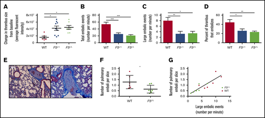 In vivo mouse model of thrombus stability in WT, F5L/+,and F5L/Lmice. The change in thrombus size from baseline (A), number of total (B) and large (C) embolic events, and percentage of thrombus that embolized (D). (E) Representative emboli images found in the pulmonary arteries of WT and F5L/L mice. Number of pulmonary emboli per lung slice (F) and the correlation between large embolic events and PE burden (G). All values are expressed as mean ± SEM; n = 6, 7, and 9 for WT, F5L/+, and F5L/L mice, respectively. *P < .05; **P < .01; ***P < .001, using a 1-way analysis of variance for panels A-D, Student t test for panel F, and linear regression for panel G.