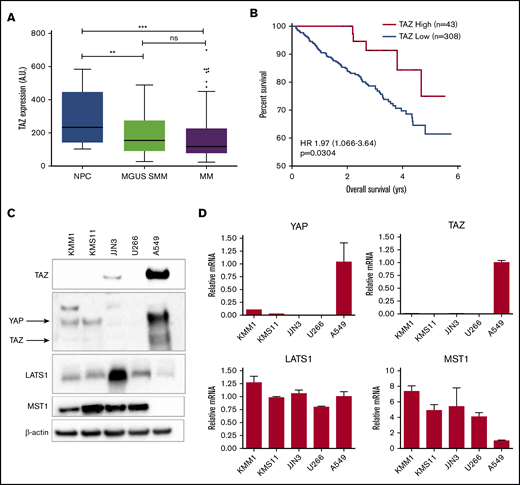 Decreased TAZ expression in MM cell lines and patient samples predicts worse outcomes. (A) Expression data comparing normal plasma cells (NPCs) from healthy subjects (n = 22), MGUS (n = 44), SMM (n = 12), and MM (n = 351), combining data from GSE5900 and GSE2658 using probe set 202134_s_at. Data are presented using box-and-whisker plots according to the Tukey method. The Student t test was used to evaluate significance: **P ≤ .01 and ***P ≤ .001. (B) Overall survival curve relative to TAZ expression in individuals affected by MM, obtained from http://www.canevolve.org/AnalysisResults/AnalysisResults.html and based on GSE2658 (log-rank test). Optimal cutoff determined using Cutoff Finder (http://molpath.charite.de/cutoff).28 (C) Immunoblot analysis of HMCLs for protein expression of TAZ, YAP, LATS1, and MST1 relative to A549 cells. (D) mRNA expression of TAZ, YAP, LATS1, and MST1 relative to A549 cells in HMCLs. A.U., arbitrary unit; HR, hazard ratio; ns, not significant.