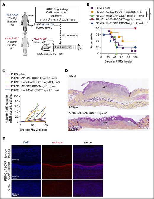 A2-CAR CD8+ Treg therapy efficiently controls HLA-A*02 mismatched skin graft allogeneic rejection. (A) Schematic depicting the model of human skin graft in NSG mice. Skin from HLA-A*02+ human healthy volunteer (HV#1) was grafted on immuno-incompetent NSG mice, and 1 month later (= day 0 of graft survival challenge), mice were IV injected with 5 × 106 PBMCs from a HLA-A*02 mismatched healthy volunteer (HV#2, HLA-A*02−) to induce an allogeneic rejection of the skin graft. A2-CAR or Her2-CAR CD8+ Tregs were generated from PBMCs of HV#2 donor and co-injected with PBMCs in grafted mice at a PBMCs:Tregs ratio of 3:1 or 1:1. (B) Survival of skin graft over time based on macroscopic features of rejection in mice treated with A2-CAR CD8+ Tregs at a ratio of PBMCs:Tregs of 3:1 (orange line, n = 6) or 1:1 (red line, n = 4) or Her2-CAR at a ratio of PBMCs:Tregs of 3:1 (green line, n = 3) or 1:1 (blue line, n = 4) or not treated (purple line, n = 9). Log rank (Mantel Cox) test, *P < .05; **P < .01. (C) Percentage human PBMCs in mouse blood over time after cell transfer. One line represents 1 mouse. (D) Representative photos of HPS coloration of human skin tissue grafted 100 days after cell transfer. Arrows show immune cell infiltrate, stars delimit human skin graft interface with mouse skin, scales are indicated on photos. (Upper) Representative photo of a skin graft of mice injected with PBMCs, macroscopic score, 3. (Lower) Representative photo of skin graft of mice injected with PBMCs and treated with A2-CAR CD8+ Tregs, macroscopic score, 2. (E) Human skin grafts were assessed 100 days after cell transfer of PBMCs ± A2-CAR CD8+ Tregs by immunofluorescence stains of 4′,6-diamidino-2-phenylindole (DAPI) and involucrin staining. Images are representative stains; scale is indicated on the bottom left.
