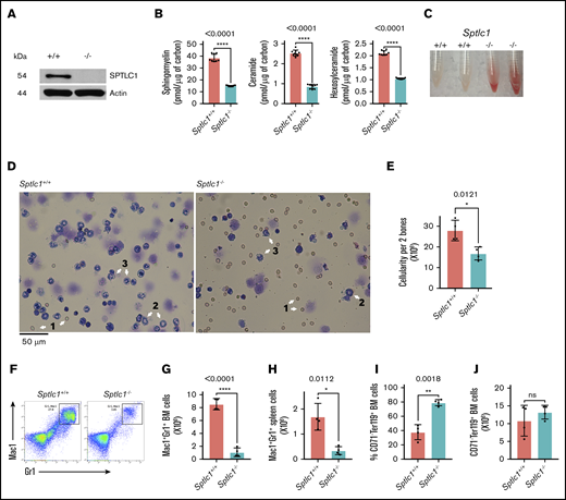 Deletion of Sptlc1 in mice using Mx1-Cre affects BM and spleen. (A) Western blot analysis for the loss of SPTLC1 protein in the Sptlc1−/− BMCs. (B) Sphingomyelin, ceramide, and hexosylceramide were analyzed by mass spectrometry and normalized to carbon content. The sphingomyelin levels were 38.5 ± 3 and 15 ± 0.4 pmol per microgram of carbon, the total ceramides were 2.5 ± 0.14 and 0.8 ± 0.1 pmol per microgram of carbon, and the hexosylceramides were 2.1 ± 0.09 and 1 ± 0.02 pmol per microgram of carbon in the Sptlc1+/+ and Sptlc1−/− BMCs, respectively. The results are from technical triplicates performed on BM cells from 3 mice of each genotype. (C) Representative images of BM tissue isolated from Sptlc1+/+ and Sptlc1−/− mice. (D) Wright-Giemsa staining of BMCs from the Sptlc1+/+ and Sptlc1−/− mice. 1, RBC; 2, metamyelocyte; and 3, segmented band cell. Scale bar, 50 μm. (E) BM cellularity was determined from 2 femurs on day 3 in the Sptlc1+/+ and Sptlc1−/− mice. (F) Myeloid differentiation in BM hematopoietic cells was analyzed by Mac-1 and Gr-1 staining 3 days after poly(I:C) injection (n = 4). (G) The total numbers of Mac-1+Gr-1+ cells were plotted for the Sptlc1+/+ and Sptlc1−/− mice (n = 4). (H) Myeloid differentiation in spleens obtained from Sptlc1+/+ and Sptlc1−/− mice was analyzed by Mac-1 and Gr-1 staining (n = 4). (I) The percentage of CD71−Ter119+ BMCs was plotted for the Sptlc1+/+ and Sptlc1−/− mice (n = 4). (J) The total numbers of CD71−Ter119+ BMCs were plotted for the Sptlc1+/+ and Sptlc1−/− mice (n = 4). All graphs are represented as mean ± standard error of the mean (SEM). P < .05 is significant, calculated from the unpaired Student t test. ns, not significant.