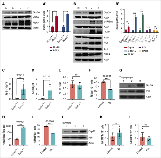 Sptlc1−/−BMCs exhibit ER stress that compromises myeloid differentiation. (A) Western blot analysis of Sptlc1+/+ and Sptlc1−/− BM cells harvested 3 days after poly(I:C) injection. Lysates were probed for Grp78 and PERK. Cleaved PERK products were detectable in the Sptlc1−/−. (A′) Quantitative data representative of 3 independent experiments. (B) Western blot analysis of cell extracts of Sptlc1+/+ and Sptlc1−/− BMCs cultured for 4 days in the presence of GM-CSF and IL-3. Lysates were probed for Grp78, p-IRE1α, PERK, PDI, and calreticulin. (B′) Quantitative data representative of 3 independent experiments. (C-E) The Grp78 (BiP) staining of Gr1, LK, and LSK cells was plotted for 5 Sptlc1+/+ and 5 Sptlc1−/− BMT mice, analyzed 4 days after poly(I:C) injection (n = 5). (F) The wild-type BM cells were cultured in the presence of GM-CSF and IL-3 factors in liquid culture with dimethyl sulfoxide (DMSO) (control) and Tg (10 nM) for 2 days and stained for Mac-1 and Gr-1. The percentage of Mac-1+Gr-1+ cells was plotted for control and Tg-treated cells (n = 6). (G) Western blot analysis of Grp78 and PDI for lysates from control and Tg-treated cells. Lanes: 1, nucleated BMCs (before culture); 2, control; and 3, Tg-treated cells. (H) The percentages of radiolabeled fatty acids were plotted for the Sptlc1+/+ and Sptlc1−/−. (I) Wild-type BM cells were cultured in the presence of GM-CSF and IL-3 with bovine serum albumin (BSA) (control) and with sodium palmitate (200 μM) for 4 days. The cells were stained for Mac-1 and Gr-1. The percentage of Mac-1+Gr-1+ cells was plotted for control and palmitate-treated cells (n = 6). (J) Western blots of Grp78 and PDI for lysates of control and palmitate-treated cells. Lanes: 1, nucleated BMCs; 2, control; and 3, palmitate-treated cells. (K) The percentage of CD71−Ter119+ cells was plotted for control and Tg-treated cells (n = 7). (L) The percentage of CD71−Ter119+ cells was plotted for control and palmitate-treated cells (n = 7). All graphs are represented as mean ± SEM. P < .05 is significant, calculated from the unpaired Student t test.