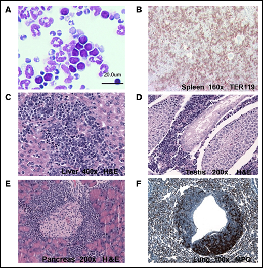 The histopathological analysis of a representative Cdx4 mouse showing the presence of erythroblasts in different mouse organs. (A) Wright-Giemsa staining of peripheral blood. (B) Ter119 staining of the spleen. Hematoxylin and eosin (H&E) staining of the liver (C), testis (D), and pancreas (E). (F) Myeloperoxidase (MPO) staining of the lung.