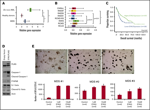 EYA2 expression and impact on survival and hematopoiesis. (A) Relative gene expression of EYA2 using the NTUH data set showing significantly higher EYA2 expression in MDS case subjects compared with control subjects. (B) EYA2 gene expression is higher in lower risk disease subtypes, including RARS and RCMD. (C) Kaplan-Meier plot showing that higher EYA2 expression is associated with improved OS. (D) Western blot showing activation of innate immune signaling after EYA2 transfection. (E) Representative micrographs (40×) of colony-forming capacity assays of control (i) or EYA2 inhibitor–treated (ii, 1 µM; iii, 10 µM) MDS bone marrow mononuclear cells showing significantly greater erythroid colonies in treated samples with accompanying quantitation for each of 3 independent samples (mean ± standard error). *P < .005, **P < .0001.