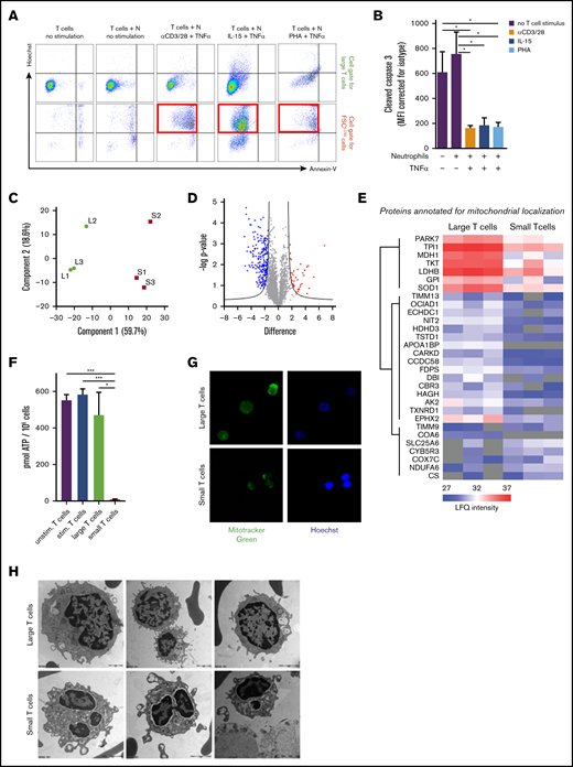 T-cell suppression is induced by a nonapoptotic pathway. T cells cultured for 2 days in the presence of IL-15 and TNF-α–activated neutrophils were harvested for flow cytometry or separated into small and large T cells by FACS for proteomic comparison, electron microscopy imaging, adenosine triphosphate (ATP) level determination, and MitoTracker staining. (A) Representative FACS plots of annexin V and Hoechst binding in cell gate for large T cells or FSClow T cells; the red squares indicate the FSClow T cells induced by MDSC activity of activated neutrophils (n = 3). (B) Flow cytometric analysis of cytoplasmic presence of cleaved caspase-3 in T cells after indicated culture conditions of 2 days (n = 4). (C) Principal component analysis of mass spectrometry label-free quantification (LFQ) intensities of small (S) and large (L) T cells. (D) Volcano plot representation of a 2-sided non-paired Student t test (small vs large T cells) with an false discovery rate of 0.05 and an S0 value of 2. Proteins more abundant in small T cells compared with large T cells are red and proteins less abundant are blue (see supplemental Table 1 for protein identification). (E) Heat plot representation of LFQ values of proteins annotated for mitochondrial localization (Human MitoCarta 2.0; 1158 entries) affected in this analysis. (F) ATP levels were measured in T cells cultured for 2 days either unstimulated (purple bars), stimulated by IL-15 and TNF-α (blue bars), or in the presence of neutrophils activated by IL-15 and TNF-α. The latter T cells were separated into large (green bars) and small (red bars) T cells (n = 3). (G) Live cell imaging of mitochondria stained with MitoTracker Green and Hoechst in small and large T cells. Shown are representative images of 3 experiments (magnification ×40). (H) Representative electron microscopy photos of small and large T cells (n = 4). Scale bar for top left image is 1 μm; scale bars for other images are 2 μm. *P < .05, ***P < .001. Stim, stimulated; Unstim, unstimulated.
