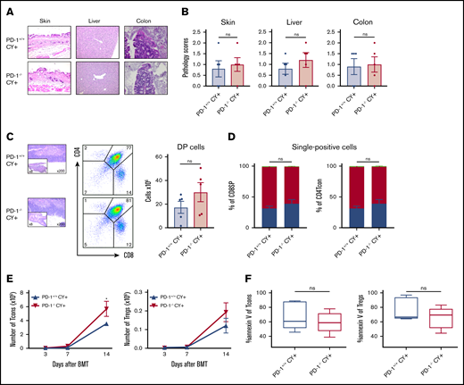 PTCy restored the balanced reconstitution of T-cell subsets and prevented tissue damage. Sublethally irradiated BDF1 recipient mice received transplants of 5 × 106 PD-1+/+ B6 or PD-1−/− B6 SPs and 5 × 106 Ly 5.1 B6 TCD-BM cells (n = 5 per group). All recipient mice were administered 50 mg/kg of PTCy intraperitoneally on day 3 after HSCT. (A) Representative images of the skin, liver, and colon from recipient mice with H&E staining are shown (magnification, ×200 for skin and liver, ×400 for colon). (B) Pathology scores of the skin, liver, and colon on day 14 after HSCT are shown. (C) Representative images of thymuses with H&E stains, lymphocyte gate of thymuses, and absolute number of DP cells in thymuses. (D) Chimerism analysis of CD8 or CD4 SP cells. Green, red, and blue indicate donor stem cell–, host-, and donor graft–derived cells, respectively. (E) Numbers of donor spleen–derived CD4 Tcons and donor spleen–derived Tregs after HSCT (CD4 Tcons, PD-1+/+ vs PD-1−/−, P < .05). (F) Annexin V expression of spleen-derived T cells on day 14 after HSCT. Data are expressed as the mean ± standard error of the mean. *P < .05.