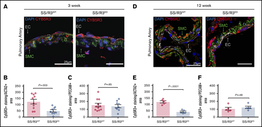 Immunofluorescent staining of lung tissue from tamoxifen-treated SS chimeras shows knockdown of SMC CYB5R3 in pulmonary arteries of SS/R3KDanimals. Representative immunofluorescent images of postmortem lung tissue from SS/R3WT and SS/R3KD chimeras showing WT (left) and knockdown (right) levels of CYB5R3 at 3 weeks (A) and 12 weeks (D) following completion of tamoxifen-induced Cyb5r3 KO. A Nikon A1 confocal laser microscope was used to image the pulmonary arteries at ×40 magnification with 1096 × 1096 resolution. Z-stack imaging (1-µm increments) of stained and immunoglobulin G control sections were used for the maximum intensity projection representative images. Smooth muscle α actin (green), CYB5R3 (red), PECAM (gray), and DAPI-stained nuclei (blue). Quantification of Cyb5R3+ per ACTA2+ (smooth muscle) area in SS/R3WT (red bar) and SS/R3KD (blue bar) chimeras completing 3- (B) and 12-week (E) studies. Quantification of Cyb5R3+ per PECAM+ (endothelial) area in SS/R3WT and SS/R3KD chimeras completing 3- (n = 9-11) (C) and 12-week studies (n = 5 each) (F). Regions of interest were drawn onto the maximum intensity projection for ACTA2 (SMC), which was then superimposed on the maximum intensity projection for CYB5R3 using ImageJ software. The quantity of CYB5R3 staining in medial smooth muscle and endothelium was determined via ImageJ using raw integrated intensity per area. The mean ± SEM is represented. The Student unpaired t test was used to determine statistical significance.