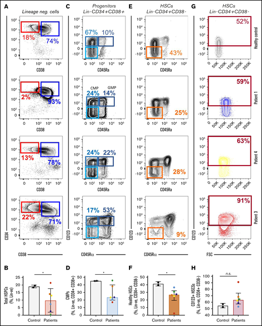 Aberrant phenotypic LSCs can be detected before the onset of sAML/sMDS. Flow cytometric analysis was conducted on collected stem and progenitor cells from patients who later developed sAML/sMDS and from mobilized controls. Patient samples demonstrated a decrease in total HSPCs (Lin− CD34+ CD38−) (A-B), a decrease in CMPs (Lin−, CD34+, CD38+, CD123+, CD45ra−) (C-D), a decrease in healthy HSPCs (Lin−, CD34+, CD38−, CD123−, CD45ra−) (E-F), and a trend toward an increase in CD123+ HSPCs (Lin−, CD34+, CD38−) (G-H). These effects were most pronounced in patient 3, who developed sAML shortly after specimen collection. Means and standard deviations for stem and progenitor populations are depicted as frequencies of parental population (top of FACS plots: panels A, C, E, and G; and y-axes: panels B, D, F, and H). Student t test: *P < .05. n.s., not significant.