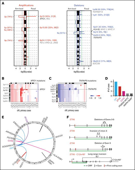 Recurrent SCNAs and chromosomal rearrangements in cHL. (A) SCNAs labeled with their associated cytoband/arm followed in parentheses by frequency of the alteration, total number of genes, and COSMIC-defined genes. SCNAs that include significantly mutated genes (black) and genes of interest (gray) are highlighted. (B) Arm-level and focal alterations of 2p/2p15. Image visibility graph (IVG) plot of copy number from chromosome 2p indicates a frequent arm-level gain with focal amplification of 2p15 region (XPO1). (C) Arm-level and focal loss of 6q/6q23.3. IGV plot of copy number from chromosome 6q indicates frequent arm-level copy loss and focal copy loss of 6q23.3 (TNFAIP3). (D) Summary of SVs in all cHLs. (E) Circos plots of identified SVs in cHL. (F) ETV6 deletions and insertions. Boxes indicate exons: red, first coding exon; white, protein-coding exon; green, open reading frame (ORF) with intervening introns.