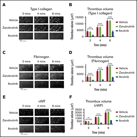 The effect of ibrutinib and zanubrutinib on in vitro human thrombus formation and growth. Fluorescently labeled whole human blood was either untreated or treated with 0.5 µM ibrutinib or 0.5 µM zanubrutinib at 37°C for 30 minutes before perfusion over 500 µg/mL type I collagen, 50 µg/mL VWF, or 100 µg/mL fibrinogen, under arterial flow conditions at a shear rate of 1800 seconds−1. Z-stack images were captured over a 6-minute period with a digital AxioCam MRm camera (Zeiss) and analyzed with Zeiss Axiovision Rel 4.6 software. 3D deconvolved reconstructions of the thrombi formed were analyzed for surface coverage of platelet aggregates (in square micrometers), thrombus height (in micrometers), and thrombus volume (in cubic micrometers). (A,C,E) Representative images of thrombus formation over type I collagen, VWF, or fibrinogen, in arterial flow conditions, in human whole blood treated with 0.5 µM ibrutinib, 0.5 µM zanubrutinib, or vehicle control over 6 minutes. Scale bars represent 20 μm. (B,D,F) Thrombus volume over time was calculated from thrombus area × thrombus height for each Btk inhibitor. Results are cumulative data from 4 independent experiments and are presented as the mean ± SEM by unpaired Student t test. **P ≤ .01, ***P ≤ .001, ****P ≤ .0001.