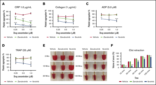 The effect of Btk inhibitors on agonist-induced platelet aggregation and clot retraction in vitro. (A-D) Human PRP was normalized to 100 × 109/L and incubated with a range of doses (0.25-1.0 µM) of ibrutinib, zanubrutinib, or vehicle control for 10 minutes at 37°C. Aggregation responses of PRP were determined after agonist stimulation by 1.0 μg/mL CRP (A), 1.0 μg/mL collagen (B), 5 μM ADP (C), and 25 μM TRAP (D). These results are represented as the mean ± SEM of 3 independent experiments. *P ≤ .05, ** P ≤ .01, *** P ≤ .005, **** P ≤ .001. Normalized PRP from a healthy human donor (100 × 109/L platelets) was left untreated or treated with 0.5 μM ibrutinib or 0.5 µM zanubrutinib for 5 minutes at 37°C. Clot formation was induced with 2.5 U/mL of thrombin and monitored over time at 37°C. (E) Representative images of clot retraction using PRP, untreated or treated with 0.5 μM ibrutinib or 0.5 µM zanubrutinib after addition of 2.5 U/mL of thrombin over time. (F) The remaining serum volume was measured and recorded after clot retraction at 15, 30, 45, 60, and 120 minutes. Data are representative of 4 independent experiments and are expressed as the mean ± SEM, by Student t test. **P ≤ .001, ***P ≤ .0001.