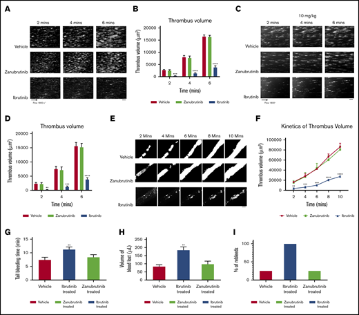The effect of ibrutinib and zanubrutinib on in vitro, ex vivo, and in vivo thrombus formation and tail bleeding time. (A-B) Fluorescently labeled whole blood of C57BL/6 mice was untreated or treated with 0.5 μM of ibrutinib or 0.5 µM of zanubrutinib and was perfused over 500 μg/mL type I collagen under arterial flow conditions at a shear rate of 1800 seconds−1. Z-stack images were captured over a 6-minute duration with a digital AxioCam MRm camera (Zeiss) and analyzed with Zeiss Axiovision Rel 4.6 software. 3D deconvolved reconstructions of thrombi formed were analyzed for surface coverage of platelet aggregates (in square micrometers), thrombus height (in micrometers), and thrombus volume (in cubic micrometers). (A) Representative images of thrombi formation over type I collagen under arterial flow conditions for wild-type mouse whole blood treated with 0.5 μM of ibrutinib or 0.5 µM of zanubrutinib vs DMSO control over 6 minutes. Scale bar represents 20 μm. (B) Thrombus volume over time was calculated from thrombus area × thrombus height. Results are cumulative data from 4 independent experiments and presented as the mean ± SEM, by the unpaired Student t test. ***P ≤ .005, ****P ≤ .001. (C-D) Fluorescently labeled whole blood of C57BL/6 mice untreated or treated with 10 mg/kg ibrutinib or 10 mg/kg zanubrutinib was perfused over 500 μg/mL type I collagen under arterial flow conditions at a shear rate of 1800 seconds−1. Z-stack images were captured over a 6-minute duration with a digital AxioCam MRm camera (Zeiss) and analyzed with Zeiss Axiovision Rel 4.6 software. 3D deconvolved reconstructions of thrombi formed were analyzed for surface coverage of platelet aggregates, thrombus height, and thrombus volume. Scale bar represents 20 μm. (E) Representative images of thrombus formation over type I collagen under arterial flow conditions for wild-type mice treated with 10 mg/kg ibrutinib or 10 mg/kg zanubrutinib vs wild-type treated with DMSO over 10 minutes. Scale bar represents 20 μm. (F) Thrombus volume over time was calculated from thrombus area × thrombus height for all mice treated with ibrutinib, zanubrutinib, or DMSO. (G) Tail bleeding times for wild-type or ibrutinib- or zanubrutinib-treated mice. (H) Volume of blood lost (in microliters) in wild-type or ibrutinib- or zanubrutinib-treated mice. (I) Percentage of unstable hemostasis determined by rebleeding occurring 1 minute after initial clot formation for wild-type or ibrutinib- or zanubrutinib-treated mice. Results are cumulative data from 4 independent experiments and are expressed as the mean ± SEM. **P ≤ .01, ***P ≤ .001, ****P ≤ .0001.
