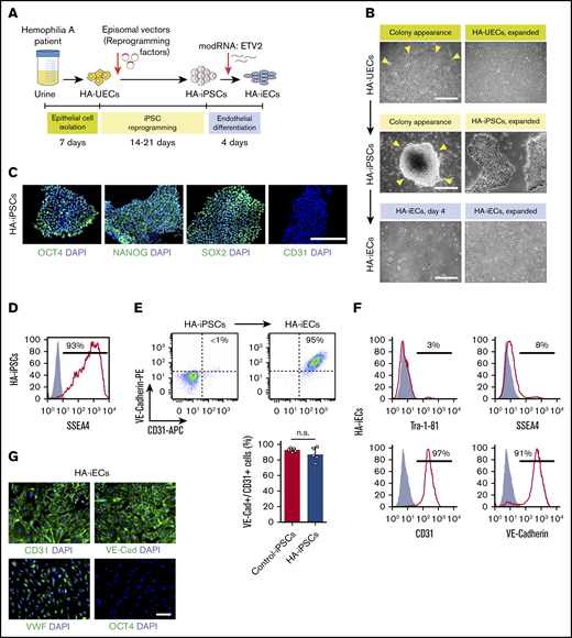 Generation of HA-iPSCs and HA-iECs from HA patients. (A) Schematic overview of epithelial cell isolation from patient urine (HA-UECs), reprogramming to HA-iPSCs through the episomal expression of reprogramming factors (OCT4, SOX2, KLF4, L-MYC, and LIN-28), and differentiation to HA-iECs using modified RNA encoding ETV2. (B) Phase-contrast imaging of the initial appearance (left) and expansion (right) of cells during the reprogramming of HA-UECs (top) to HA-iPSCs (middle), and subsequent differentiation into HA-iECs (bottom). (C) Immunofluorescence staining of HA-iPSCs for stem cell markers OCT4, SOX2, and NANOG, and endothelial cell marker CD31. Cell nuclei stained by 4′,6-diamidino-2-phenylindole (DAPI). (D) Flow cytometry analysis of HA-iPSCs for stem cell surface marker SSEA4 . Solid gray isotype-matched control is overlaid on the histogram. (E) Differentiation efficiency of HA-iPSCs into CD31+/VE-Cadherin+ HA-iECs (top right box) quantified by flow cytometry and compared with the efficiency in nonhemophilic human iPSC clones (Control-iPSCs). Bars represent mean ± standard deviation (SD). (F) Flow cytometry analysis of HA-iECs for endothelial cell surface markers CD31 and VE-Cadherin, and stem cell surface markers SSEA4 and Tra-1-81. Solid gray isotype-matched controls are overlaid on each histogram. (G) Immunofluorescent staining of HA-iECs for endothelial cell markers CD31, VE-Cadherin, and VWF, and stem cell marker OCT4. Cell nuclei stained by DAPI. Scale bars, 100 μm (G), 200 μm (C), and 500 μm (B). n.s., no statistical differences.
