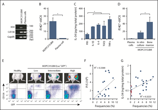 Figure 1. IL-34 expression in MOPC315.BM cells. (A) PCR analysis of Il34, Cd138, and Gapdh expression in MOPC315.BM cells compared with normal plasma cells. (B) Relative expression of Il34 expression in MOPC315.BM cells compared with normal plasma cells (normalized to Gapdh). (C) Enzyme-linked immunosorbent assay (ELISA) measurement of IL-34 in the supernatants of MOPC315.BM cells stimulated for 7 days with IL-1β, IL-6, TGFβ, or TNFα (100 ng/mL) compared with PBS. (D) qRT-PCR analysis of Il34 expression in MOPC315.BM cells purified directly from the BM (day 30 after IV injection) or cultured in vitro compared with plasma cells (normalized to Gapdh). (E) Individual variability of MOPC315.BM cells homing to the bones. Top panel, The bioluminescence signals in representative BALB/c mice challenged with Luc+GFP+ MOPC315.BM cells compared with healthy controls. Bottom panel, Populations of CD138+GFP+ cells (MOPC315.BM) in the BM of femurs as analyzed by flow cytometry (day 30 after IV injection). (F) The correlation between frequencies of Luc+GFP+ MOPC315.BM cells with bioluminescence signals in femurs. (G) The correlation between frequencies of Luc+GFP+ MOPC315.BM cells with protein levels of IL-34 in the BMF of femurs. Red dots indicate levels of normal IL-34 levels in healthy controls. Data are mean ± standard error of the mean (SEM); *P < .05. ddCt, delta-delta cycle threshold; P/S, photon/second.