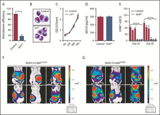 Figure 2. Knocking down Il34 expression in MOPC315.BM cells. (A) Knockdown efficiency of Il34 expression in MOPC315.BM cells that stably express Il34-specific siRNA compared with control as evaluated by qRT-PCR (control = 100%). (B) Cellular morphology of MOPC315.BMControl (top: hematoxylin and eosin stain; original magnification ×20) or MOPC315.BMIl34KD (bottom: hematoxylin and eosin stain; original magnification ×20) cells. (C) Cell proliferation as compared between MOPC315.BMControl and MOPC315.BMIl34KD cells. (D) ELISA measurement of M315 protein in the supernatants of MOPC315.BMControl or MOPC315.BMIl34KD cell cultures. (E) qRT-PCR analysis of Il34 expression in MOPC315.BMControl or MOPC315.BMIl34KD cells collected from bones of mice (n = 3) at day 30 or day 45 postinjection (normalized to Gapdh). (F-G) Bioluminescence imaging in representative BALB/c mice challenged with MOPC315.BMControl (F) or MOPC315.BMIl34KD cells (G) at day 45 postinjection. Ventral and dorsal views are shown in the top and bottom panels, respectively. Data are mean ± SEM; *P < .05. OD, optical density.