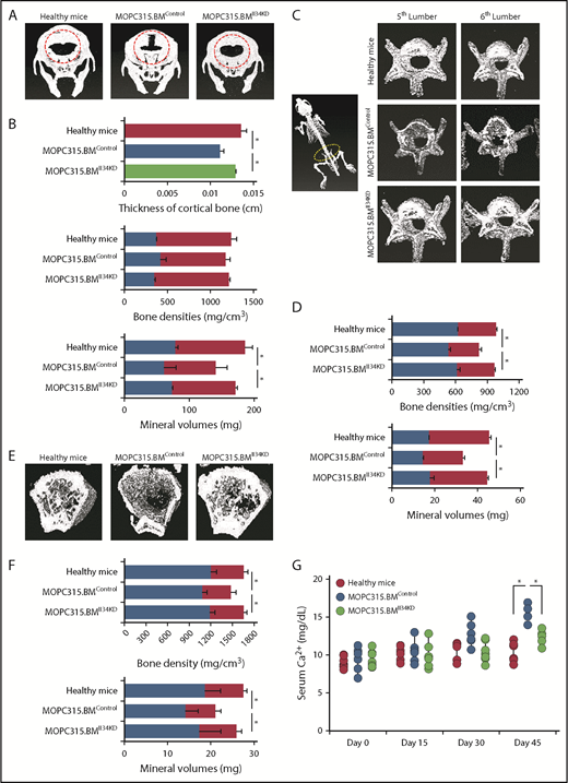 Figure 4. IL-34 accelerates MM-induced osteolysis in mice. (A) Transmission radiographs of the skull of mice IV injected with MM cells (MOPC315.BMControl or MOPC315.BMIl34KD) at day 45 postinjection, compared with age-matched healthy controls. Red circles refer to regions with severe bone lesions. (B) Quantitation of cortical bone thickness (centimeters), bone densities (milligrams per centimeter-cubed), and mineral volumes (milligrams) of regions described in panel A. (C) Transmission radiographs of the fifth and sixth lumbar vertebrae of mice described in panel A. (D) Quantitation of bone densities (milligrams per centimeter-cubed) and mineral volumes (milligrams) of regions described in panel C. (E) Transmission radiographs of femurs of mice described in panel A. (F) Quantitation of bone densities (milligrams per centimeter-cubed) and mineral volumes (milligrams) of regions described in panel E. Blue bars, cortical structures; red bars, trabecular structures. (G) Measurement of serum Ca2+ levels in mice described in panel A at the indicated days after injection. Data are mean ± SEM; *P < .05.