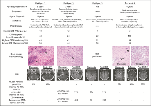 Figure 1. Baseline and posttreatment CNS-HLH patient characteristics. Baseline characteristics for all patients in this study, including age at onset of symptoms, nature of clinical symptoms, age at eventual diagnosis, familial HLH mutation, therapy received before CNS-HLH diagnosis, CSF assessment, and hematoxylin and eosin–stained brain biopsy histopathology (20× magnification). Black arrows indicate perivascular lymphocytic infiltrates. Also displayed are T1 MRI scans and NK-cell immunologic tests at diagnosis and after HCT. White arrows indicate contrast-enhancing MRI lesions. -, NK-cell testing not indicated for the patient’s specific mutation. HCT, hematopoietic cell transplantation; IVIG, intravenous immune globulin; MMF, mycophenolate mofetil; NK, natural killer; WBC, white blood cell.
