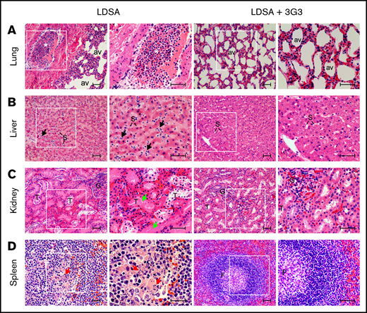 Histopathology of vital organs of euthanized baboons following LD of heat-inactivated S aureus challenge with or without 3G3 pretreatment. Lung (A), liver (B), kidney (C), and spleen (D) were collected at the time of necropsy, embedded in paraffin, and stained with hematoxylin and eosin. Images were acquired on an upright Nikon Eclipse E800M microscope equipped with an Omax high-speed digital camera using the Omax ToupView software. For each organ and experimental condition, representative images showing both low and high magnification insets are shown. Scale bars, 100 µm. av, lung alveoli; F, spleen follicle; G, kidney glomeruli; S, liver sinusoidal capillaries; T, renal tubuli. Black arrows, neutrophils infiltration in the subsinusoidal space; green arrows, tubular necrosis; red arrows, lymphoid apoptosis. *Intravascular leukocyte aggregation.