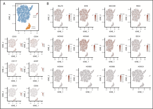 Figure 2. Single-cell RNA expression analysis. (A) tSNE plot with coloring according to cell type as determined by marker gene expression and as depicted in the heatmaps. Expression level is provided as UMI counts. (B) Expression of selected genes across all cells. tSNE, t-distributed stochastic neighbor embedding.