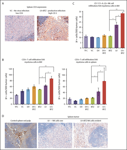 Figure 3. Early tumor microenvironment events indicate that RV + BTZ combination therapy leads to significantly enhanced immune activation. (A) IHC staining of CD3 in spleens of mice. Note the rare tumor associated CD3+ cells in the mice treated with the VC compared with the strong infiltration by such cells in the tumor after treatment with LV and BTZ (magnification ×200 = ×10 and ×20). (B) Bar plots representing quantified CD3+ cells in BM and spleen. N = 3; **P < .01, *P < .05, Conover’s test. (C) Bar plots representing quantified CD117+ IL22+ NK cells in BM. N = 3; **P < .01, *P < .05, Conover’s test. (D) IHC sections of mouse spleens stained for NK cells. IHC staining of CD117+ IL22+ NK cells in spleens of mice. Note the rare NK cell distribution in LV-treated spleens, robust expression of NK cells in LV + BTZ–treated spleens, and red pulp areas of mouse spleen (magnification ×200 = ×10 and ×20). (A,D) Camera: Ventana Vias Zeiss Axio; acquisition software: Nuance. Composite figure via Adobe Photoshop CS4.