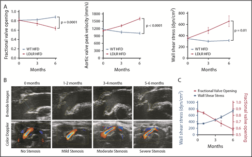 Figure 1. Development of aortic stenosis in LDLR mice. (A) Stenosis parameters (fractional valve opening, WSS, and AV peak velocity) in LDLR mice on HFD (n = 10-48) and WT mice on HFD (n = 5-13) at 0, 3, and 6 months after initiation of HFD, as measured by echocardiography. (B, top) Ultrasound images of AV from LDLR mice at indicated time on HFD. (B, bottom) Ultrasound B-mode images with color Doppler of blood flow through aortic valves in LDLR mice at indicated timepoints. Yellow lines outline the aortic valves and blue lines indicate cusp separation at systole. Black line represents the Doppler line in the color Doppler images. (C) Fractional valve opening (right y-axis) and wall shear stress (left y-axis) in LDLR mice fed HFD at indicated timepoints (n = 7-31). Two-tailed unpaired Student t test with Welch’s correction was used to compare 2 groups with different sample sizes. Data represented as mean ± SEM throughout.