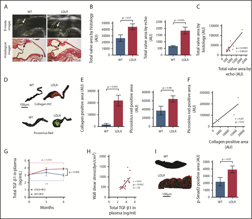 Figure 2. A robust and aggressive mouse model of aortic stenosis. (A) Ultrasound B-mode images (upper panels) and histological pictures (lower panels) of aortic valves in WT and LDLR mice on HFD. Yellow lines and black lines outline the AVs; arrows indicate AV leaflets. (B) Total valve area measured from echocardiographic images (n = 14 WT; n = 9 LDLR) and from histological images (n = 14 WT; n = 19 LDLR) of AV from mice at 6 months on HFD. (C) Pearson correlation of AV areas measured from echocardiography and histology (r = 0.8626; P < .0001; n = 16). (D-E) Immunohistochemistry for α-1 type I collagen (n = 4 WT; n = 5 LDLR) and picrosirius red staining for collagen (n = 8 WT; n = 17 LDLR) in AV from WT and LDLR mice after 6 months on HFD. Quantification of collagen staining in the valves by immunohistochemical (left) and picrosirius red (right) staining. (F) Pearson correlation of collagen positive area measured from immunohistochemical and picrosirius red-stained images of AV in LDLR mice after 6 months on HFD (r = 0.87; P = .055; n = 5). (G) Total TGF-β1 levels in the plasma of LDLR and WT mice at 0, 3, and 6 months on HFD, as measured by ELISA. (H) Pearson correlation of WSS across aortic valves and plasma TGF-β1 levels in LDLR mice at 6 months on HFD (r = 0.63; P = .002; n = 20). (I) Representative images of immunofluorescent staining for p-Smad2 in aortic valves from WT and LDLR mice after 6 months on HFD and quantification of p-Smad2–positive nuclei in the aortic valves of WT (n = 5) and LDLR (n = 10) mice after 6 months of HFD (see supplemental Figure 6 for individual valves with p-Smad2 staining). Two-tailed unpaired Student t test with Welch’s correction was used to compare 2 groups with different sample sizes. Data represented as mean ± SEM throughout.