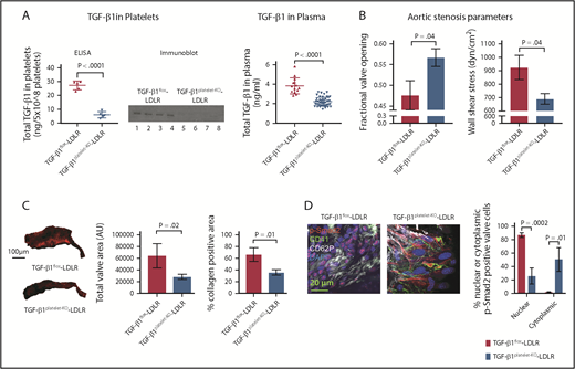 Figure 4. Platelet TGF-β1 contributes to AS progression. (A) ELISA and immunoblot for total platelet TGF-β1 (left and middle panel) in TGF-β1platelet-KO-LDLR mice (n = 5) and TGF-β1flox-LDLR controls (n = 5). Immunoblot with anti-TGF-β1 antibody showing 25 kD TGF-β1 bands (lanes 1, 2, 3, and 4 represent platelet releasates from TGF-β1flox-LDLR controls, and lanes 5, 6, 7, and 8 represent platelet releasates from TGF-β1platelet-KO-LDLR mice). Equal number of platelets (5 × 108) were used to prepare platelet releasates from each mouse. Total plasma TGF-β1 (right panel) in TGF-β1platelet-KO-LDLR mice (n = 45) and TGF-β1flox-LDLR controls (n = 14). (B) AS parameters: fractional valve opening and WSS in TGF-β1platelet-KO- LDLR mice (n = 15) and TGF-β1flox-LDLR controls (n = 7) at 6 months on HFD, as measured by echocardiography. (C) Representative images (left panel) of α-1 type I collagen stained aortic valves from TGF-β1platelet-KO- LDLR mice and TGF-β1flox-LDLR control mice after 6 months on HFD. Quantification of total valve area (middle panel) and collagen-positive area (right panel) in aortic valves of TGF-β1platelet-KO- LDLR mice (n = 4) and TGF-β1flox-LDLR controls (n = 4) at 6 months on HFD from immunohistochemical staining images. (D) Whole-mount confocal (maximum intensity projection) images showing activated platelets adjacent to valvular cells in a TGF-β1platelet-KO-LDLR mouse and a TGF-β1flox-LDLR control. Images also show intracellular p-Smad2 localization in the valvular cells. Whole-mount staining done for CD41 (green), CD62P (gray), p-Smad2 (red), and DAPI (blue). Quantification of nuclear or cytoplasmic p-Smad2 in aortic valves of TGF-β1platelet-KO-LDLR and littermate TGF-β1flox-LDLR control mice at 6 months on HFD (right panel). Two-tailed unpaired Student t test with Welch’s correction was used to compare 2 groups with different sample sizes. Data represented as mean ± SEM throughout.