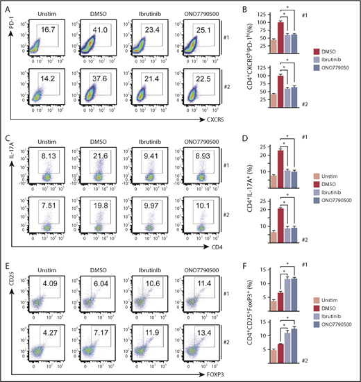 Figure 2. ITKi alter functional polarization of PTCL cells. (A) Flow cytometry dot plots showing PD-1 and CXCR5 expression of unstimulated cells and cells following 4 days’ stimulation with anti-CD3/anti-CD28/IL-12 in the absence (DMSO) or presence of ITKi (ibrutinib or ONO7790500) for patients 1 and 2. Numbers indicate the percentage of CD4+ T cells within the gate. (B) Column plots for patients 1 and 2 showing Tfh-like (CD4+CXCR5hiPD-1hi) cells as a percentage of total CD4+ cells relative to the percentage obtained with anti-CD3/anti-CD28 and IL-12 in the absence of drug (DMSO) (red columns). Blue columns represent drug treatment with ibrutinib or ONO7790500 as indicated. Drug treatment caused significant reduction in percentage of CD4+CXCR5hiPD-1hi cells. Ibrutinib (paired Student t test, patient 1 P = .017; patient 2, P = .016) and ONO7790500 (patient 1, P = .010; patient 2, P = .027). (C) Flow cytometry dot plots showing CD4 and IL-17A expression of unstimulated cells and cells following 2 days’ stimulation under Th17 polarizing conditions in the absence (DMSO) or presence of ITKi (ibrutinib or ONO7790500) for patients 1 and 2. Numbers indicate the percentage of CD4+ T cells within the gate. (D) Column plots for patients 1 and 2 showing CD4+IL-17A+ cells as a percentage of total CD4+ cells. Blue columns represent drug treatment with ibrutinib or ONO7790500 as indicated. CD4+IL-17A+ cells as a percentage of total CD4+ cells, without stimulation (Unstim), is represented by the pink column. Drug treatment caused significant reduction in CD4+IL-17A+ cells. Ibrutinib (paired Student t test, patient 1, P = .017; patient 2, P = .016) and ONO7790500 (patient 1, P = .013; patient 2, P = .013). (E) Flow cytometry dot plots showing FoxP3 and CD25 expression of unstimulated cells and cells following 2 days’ stimulation under Treg polarizing culture conditions in the absence (DMSO) or presence of ITKi (ibrutinib or ONO7790500) for patients 1 and 2. Numbers indicate the percentage of CD4+ T cells within the gate. (F) Column plots for patients 1 and 2 showing CD4+CD25+FoxP3+ Treg-like cells as a percentage of total CD4+ cells. Blue columns represent drug treatment with ibrutinib or ONO7790500 as indicated. Unstimulated cells are represented by the pink column. Drug treatment caused a significant increase in percentage of Treg-like cells. Ibrutinib (paired Student t test, patient 1, P = .045; patient 2, P = .043) and ONO7790500 (patient 1, P = .021; patient 2, P = .034). *P < .05.