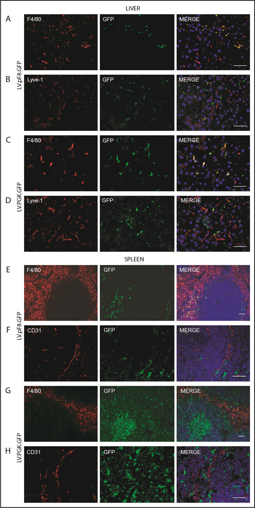 Figure 6. GFP expression in liver and spleen of pF8-Lin− transplanted mice. Immunofluorescence analysis of liver sections from pF8-Lin− (A-B) and PGK-Lin− C57Bl/6 transplanted mice (C-D). Immunofluorescence analysis of the spleens of pF8-Lin− (E-F) and PGK-Lin− transplanted mice (G-H). Scale bars, 50 μm.