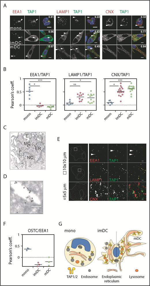 Figure 4. TAP location changes from endosomes to the ER and lysosomes. (A) Immunofluorescent staining of the early endosomes (EEA1), lysosomes (LAMP1), the ER membrane marker calnexin (CNX), and TAP1 in monocytes, imDCs, and mDCs. Scale bars, 5 µm. (B) Statistical analysis of Pearson coefficients obtained in 4 independent experiments (white circles represent donors; the mean is shown as a black line). ***P ≤ .0001; **P ≤ .001; *P ≤ .05; Kruskal-Wallis test with Dunn’s correction for multiple comparison. (C) Electron microscopy of monocytes. Scale bar, 500 nm. (D) Magnification of the area indicated in panel C. Scale bar, 150 nm. (E) Stochastic optical reconstruction microscopy (N-STORM) of mDCs stained for EEA1, LAMP1, CNX, and TAP1. Scale bars, 1 µm; CNX/TAP1 photo scale bar, 0.5 µm. One of 2 independent experiments is shown. (F) Statistical analysis of Pearson coefficients obtained in 2 independent experiments of OST and TAP1 costaining (white circles represent donors; the mean is shown as a black line). (G) Model of TAP relocalization during moDC differentiation. TAP is expressed in EEA1+ endosomes of monocytes and relocalizes to the ER (CNX+) and LAMP1+ lysosomes in moDCs. The size of TAP1/2 heterodimer in the cartoon is according to its protein expression level and inversely correlates with its activity. The nucleus is shown in blue and the Golgi apparatus as brown tubular structures. E, endosome, TAP1 (15-nm gold particles); ER, ER membrane stacks; L, lysosome; MC, mitochondria; NC, nucleus.