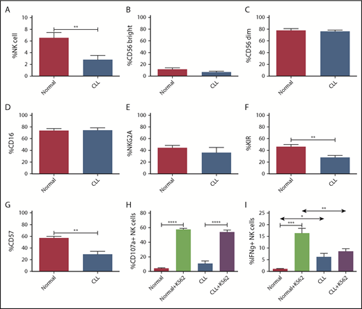 Figure 1. Phenotypic and functional characteristics of CLL patient vs healthy donor NK cells. Frozen PBMCs obtained from CLL patients (n = 9) and healthy donors (n = 9) were thawed and rested overnight and then used for flow cytometric analysis. (A) Pooled data showing proportion of CD56+/CD3− NK cells within the lymphocyte gate in CLL patients vs healthy donors. While gating on NK cells, further subgating was carried out to evaluate the proportions of CD56bright (B) vs CD56dim (C) NK cells, as well as the proportions of NK cells expressing CD16 (D), NKG2A (E), KIR (F), and CD57 (G). NK cell degranulation via CD107a expression (H) and IFNγ production (I) were evaluated in CLL patient samples and healthy donors upon triggering natural cytotoxicity by incubation with K562 targets (n = 9 for CLL and for healthy donors, respectively). (A-G,I) Unpaired Student t test used for comparison between CLL samples and normal donor samples. (H-I) Paired Student t test used for internal group comparisons. Error bars indicate the mean ± standard error of the mean. Statistical significance are determined as *P < .05, **P < .01, ***P < .001, and ****P < .0001.