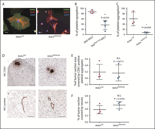 Figure 5. PDPN deletion in reactive astrocytes does not affect intratumoral platelet aggregates. (A) Immunofluorescence staining of astrocytes isolated from mice with the indicated genotype. PDPN (green), GFAP (red), DAPI (blue). Scale bars, 20 µm. (B) In vitro platelet aggregation (percentage) of platelets incubated with tumor cells isolated from DKO-NSC and TKOPdpn neg-NSC orthotopic gliomas. Mean ± standard deviation shown. n = 3; statistical analysis: Student t test. (C) In vitro platelet aggregation (percentage) of platelets incubated with astrocytes isolated from control and AstroPDPN-KO mice. Mean ± standard deviation shown. n = 3; statistical analysis: Student t test. (D) CD61 and laminin staining (brown) of sections from DKO-NSCs orthotopic tumors in AstroCtrl (mice carrying Pdpn-flox alleles) and AstroPDPN-KO mice. The sections were counterstained with hematoxylin. Scale bars, 100 µm. Quantification of tumor area covered by CD61 (E) and laminin (F) staining. Mean ± standard deviation shown. n = 4; statistical analysis: Student t test. *P < .05; **P < .01.