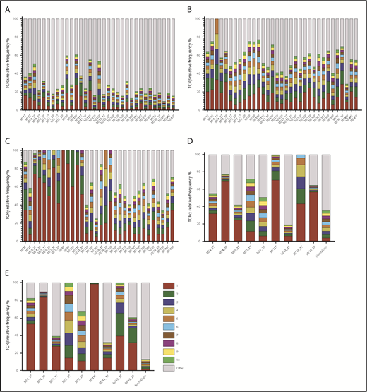 Figure 3. Relative frequency of T-cell clonotypes. TCRα (A), TCRβ (B), and TCRγ (C) repertoire sequences identified from WES of MF samples. Sample ID relates to patient number, as in Figure 1, with the suffix P (plaque) or T (tumor). TCRα (D) and TCRβ (E) repertoires identified by WTS of MF samples. Each bar represents an individual CDR3 amino acid clonotype, with red and green indicating the first-ranked and tenth-ranked clonotype, respectively, in decreasing order of relative frequency. Gray bars represent the rest of the identified clonotypes in the samples. NormalLym, pooled CD4+ normal lymphocytes from 4 healthy donors.