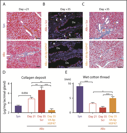 Figure 3. VA-lip HSP47 eye drops resolve established lacrimal gland fibrosis in chronic GVHD. Mice were transplanted as in Figure 1. A group of allogeneic recipients (Allo) was treated with VA-lip HSP47 eye drops or VA-lip Scr eye drops daily from day +21 to day +34, and the lacrimal glands were harvested on day +35 post-BMT. (A) Representative images of MT staining of lacrimal glands harvested from syngeneic (Syn; upper panel) or Allo (lower panel) recipients on day +21 posttransplant. Scale bars, 50 µm. (B) Immunofluorescent images for HSP47 (red) with DAPI (blue) counterstaining on day +35. Arrows point to HSP47+ fibroblasts. Scale bars, 50 µm. (C) MT staining of lacrimal glands harvested from Allo mice given VA-lip Scr (Allo + Scr; upper panel) and Allo mice given VA-lip HSP47 (Allo + VA-lip HSP47; lower panel) on day +35 post-BMT. Scale bars, 50 µm. (D) The amount of collagen deposition in the lacrimal glands was evaluated before (Allo Day 21, n = 8) and after ocular instillation with VA-lip Scr (Allo + Scr Day 35, n = 8) or VA-lip HSP47 (Allo + VA-lip HSP47 Day 35, n = 7). Syn controls were evaluated on day +21 (n = 8). (E) Tear secretion was assessed before initiation of ocular instillation (Allo Day 21, n = 18) and after ocular instillation with VA-lip Scr (Allo + Scr Day 35, n = 8) or VA-lip HSP47 (Allo + VA-lip HSP47 Day 35, n = 10). Syn controls were evaluated on day +21 (n = 8). (D-E) Data from 2 similar experiments were combined. *P < .05; **P < .01; ***P < .005.