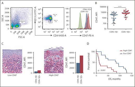 Figure 1. CD47 is overexpressed on Sézary cells and correlates with worse OS. (A) Representative fluorescence-activated cell sorter (FACS) plots of gating strategy identifying CD47 expression on Sézary cells (with a dominant Vβ13.2+ T-cell population) in comparison with nonmalignant T cells (CD4+Vβ13.2−) in a patient with SS. CD47 expression was determined on Sézary cells (red histogram) compared with nonmalignant CD4+ cells (blue histogram) and isotype control (green histogram). (B) The MFI of CD47 on CD4+Vβ+ (Sézary cells, red) and matched CD4+Vβ− (nonmalignant lymphocytes, blue) cells in patients with SS (n = 25). Two-tailed unpaired Student t test (****P < .0001). (C) Representative immunohistochemistry (IHC) samples of the skin biopsy from a patient with SS with low CD47 expression (left panel) and 1 with high CD47 expression (right panel) (anti-CD47 with red chromagen stain; original magnification ×40). The level of expression of CD47 on Sézary cells in the peripheral blood determined by flow cytometry provided on the right of the corresponding skin biopsy. (D) Kaplan-Meier curves of OS (months) of patients with SS having a low CD47 expression on Sézary cells (<6537 MFI) vs high CD47 expression (>6537 MFI) on Sézary cells (n = 25). Log-rank (Mantel-Cox) test (P < .001). FITC-A, fluorescein isothiocyanate area; FSC-A, forward scatter area; PE-A, phycoerythrin area; SSC-A, side scatter area.