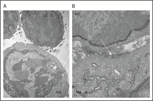 Figure 4. TTI-621 (arrow) can be observed at the interface between the Sézary cell and macrophage. Gold-labeled TTI-621 was incubated with Sézary cells and macrophages for 5 minutes before scanning electron microscopy. (A) Sézary cell (SzC) attached to Mϕ (original magnification ×15 000). (B) Gold-labeled TTI-621 at the interface between the Sézary cell and the Mϕ (original magnification ×50 000).