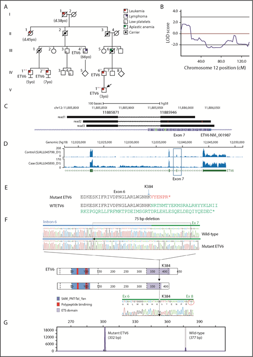 Figure 1. Linkage mapping to chromosome 12 in a kindred with ALL and DLBCL. (A) A 5-generation kindred with 10 individuals with leukemia, DLBCL, aplastic anemia, and/or thrombocytopenia. Black crosses indicate samples subjected to WGS, and red crosses indicate samples subjected to WES. Squares and circles represent male and females, respectively. All family members with ALL or DLBCL sequenced harbored the ETV6 deletion. Individuals III.3 and III.4 (DLBCL) both had thrombocytopenia and the deletion; IV.3 and III.2 had normal platelet counts and no ETV6 deletion. (B) Multipoint linkage results highlighting region with a logarithm of the odds (LOD) score of 1.8. (C) Representative reads showing the exon 7 splice site deletion identified by WGS SV analysis (NM_001987.4:G.11885871_11885946del;NM_001987.4:c.1153-55_1173del). (D) RNA-sequencing coverage analysis showing reduced sequence depth at exon 7. (E) Protein truncation resulting from exon skipping. (F) Schematic representation of the ETV6 protein, including the sterile α motif (SAM)/pointed domain of Tel/Yan protein, the polypeptide -binding domain, and the erythroblast transformation-specific domain (ETS). The top pair of electropherograms is from genomic PCR and Sanger sequencing and compares wild-type (WT) and deleted (75-bp) ETV6. Dotted line in the ETV6 cartoon represents exon junctions. The lower electropherogram is from RT-PCR and Sanger sequencing and shows the skipping of exon 7 and splicing of exon 6 to exon 8 in tumor RNA. (G) Results from fragment size analysis showing amplification of both WT and deleted ETV6 alleles.