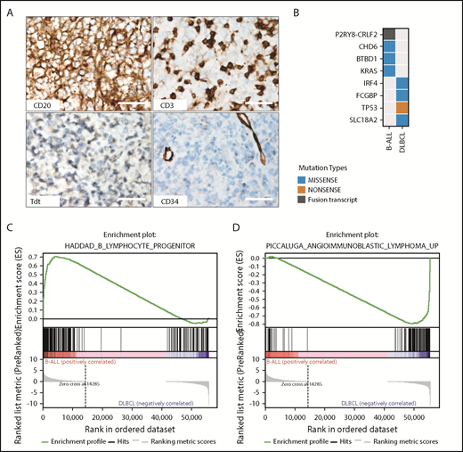 Figure 2. Characterization of tumors in the ETV6-mutated kindred. (A) Immunohistochemistry of the DLBCL tumor is consistent with mature B-cell lineage, with expression of CD20 and lack of expression of the immature markers CD34 and TdT and the T-cell marker CD3, which highlights admixed small T cells (original magnification ×40; scale bars, 50 μm). (B) Mutational analysis of WGS data showing distinct ALL and DLBCL mutational spectra of each sample. (C) Gene set enrichment analysis (GSEA) from RNA sequencing of tumor sample showing enrichment of B lymphoid progenitor genes in the B-cell ALL sample (D) and genes expressed in lymphoma in the DLBCL sample. Collectively, the pathologic and genomic features support a true DLBCL in case III.4 rather than a lymphomatous presentation of ALL. Tdt, terminal deoxynucleotidyltransferase.