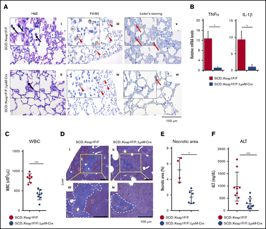 Specific activation of Nrf2 in monocytes/granulocytes alleviates inflammatory damage. (A) hematoxylin and eosin (H&E), F4/80, and chloroacetate esterase (Leder staining) staining of lungs from SCD::Keap1F/F (i,iii,v) mice and SCD::Keap1F/F::LysM-Cre (ii,iv,vi) mice showing congestion of the lungs and infiltration of inflammatory cells (i-ii), specifically macrophages (iii-iv) and neutrophils (v-vi). Black arrows show myeloid cells; arrowheads indicate macrophages, and red arrows denote neutrophils. Scale bar, 100 µm. (B) mRNA expression levels of tumor necrosis factor-α (TNF-α; left) and interleukin-1β (IL-1β; right) in the lungs of SCD::Keap1F/F (n = 6) and SCD::Keap1F/F::LysM-Cre mice (n = 6). (C) WBC counts in the peripheral blood of SCD::Keap1F/F (n = 7) and SCD::Keap1 F/F::LysM-Cre mice (n = 8). (D) Masson trichrome staining of livers from SCD::Keap1F/F (i,iii) and SCD::Keap1 F/F::LysM-Cre mice (ii,iv). Necrotic areas are delimited by dotted white lines. The areas in yellow squares are enlarged in panels iii-iv. (E) Quantification of necrotic areas in the liver. (F) Liver ALT levels of SCD::Keap1F/F (n = 9) and SCD::Keap1F/F::LysM-Cre mice (n = 11). The bar graphs represent the mean ± standard deviation. *P < .05; ***P < .001.