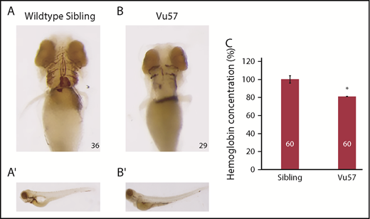 Figure 1. Mutations in hmgcs1 cause a decrease in hemoglobinized RBCs. (A-B) hmgcs1−/− (Vu57) and their wild-type siblings (hmgcs1+/+) were stained for hemoglobinized RBCs at 4 dpf (n = 36 hmgcs1+/+, n = 29 hmgcs1−/−) using o-dianisidine. Ventral views (A-B) of the hemoglobinized RBCs are shown with full body images (A′-B′) of both wild-type siblings and homozygous mutants (Vu57). The phenotype was completely penetrant in homozygous mutants. Total numbers of animals were obtained across a minimum 3 biological replicates. Images were taken with a 10× optical lens at 8× (A-B) and 6.3× (A′-B′) objective zoom. (C) The concentration of hemoglobin was measured in siblings (a pool of wild-type and heterozygous individuals) and embryos carrying the Vu57 allele. The assay was performed with 2 biological replicates with a total of 60 larvae. *P < .05.