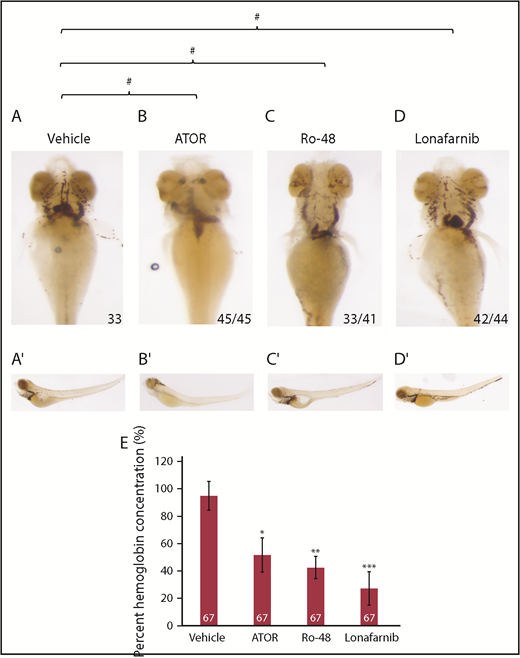 Figure 4. Cholesterol and isoprenoids regulate erythropoiesis. (A-D) Embryos were treated at sphere stage with ATOR, Ro 48 8071 (Ro-48) to inhibit cholesterol, lonafarnib to inhibit isoprenoids, or vehicle control (DMSO). At 4 dpf, embryos (n = 33 DMSO, n = 45 ATOR, n = 41 Ro-48, and n = 44 lonafarnib) were stained with o-dianisidine to observe mature RBCs. (A′-D′) Full body images of stained larvae at 4 dpf. Images were taken with a 10× optical lens at 8× (A-D) and 6.3× (A′-D′) objective zoom. #P = .0001. P value indicates the number of affected embryos affected is statistically significant according to Fisher’s exact test. (E) The concentration of hemoglobin was measured in embryos treated with ATOR, Ro-48 to inhibit cholesterol, lonafarnib to inhibit isoprenoids, or vehicle control (DMSO) at 4 dpf. The number indicates total larvae analyzed across 3 biological replicates. *P = .000381218, **P = 2.20098e-05, ***P = 1.42e-05.