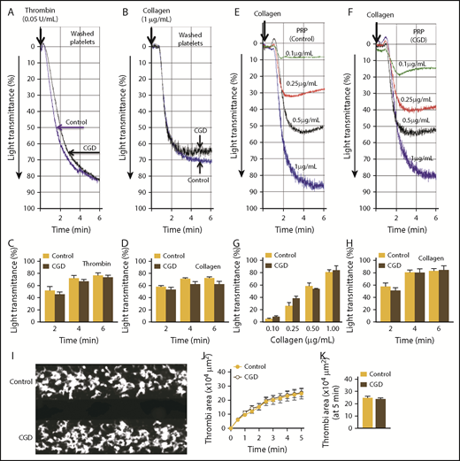 Figure 6. Platelets from CGD patients have similar aggregation and adhesion responses as platelets from healthy control subjects. Platelet aggregation was examined using washed platelets (A-D) or PRP (E-H). Representative aggregation tracings for washed platelets stimulated with thrombin (0.05 U/mL; A) or collagen (1.0 μg/mL; B). Summary data for aggregation kinetics with thrombin (C) or collagen (D). Representative tracings for dose-dependent platelet aggregation to collagen with PRP from control subjects (E) and CGD patients (F). Summary data for maximal aggregation (G) and aggregation kinetics (H) with 1.0 µg/mL collagen of platelets from control subjects vs. CGD patients. Accumulation of platelet thrombi over collagen was examined in a microfluidic flow chamber at a shear rate of 2000/s. (I) Representative images of platelet accumulation/thrombi formation with platelets from control subjects vs. CGD patients. (J) Time course of accumulation of platelets/thrombi development, calculated as the surface area covered by platelets in a fixed field. (K) Total thrombi area after 5 minutes of perfusion, calculated as the average surface area covered by platelets in 5 representative fields. Composite data are presented from 3 separate runs (2 CGD patients and 3 age-matched control subjects; 1 CGD patient donated a blood sample 2 times).