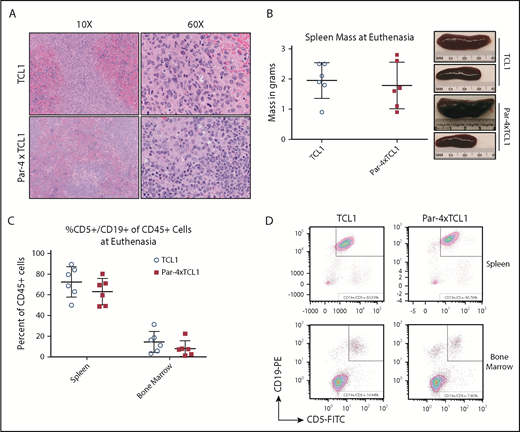 Figure 4. Infiltration of the spleen by malignant lymphocytes in TCL1 and Par-4 × TCL1 mice. Tissues were collected from mice that met euthanasia criteria and analyzed for infiltration by leukemic B cells. (A) Formalin-fixed paraffin-embedded spleen sections stained with hematoxylin and eosin viewed at original magnification ×10 and ×60 showing infiltration of neoplastic round cells. (B) Mass of spleens excised from animals upon euthanasia, with representative images from the indicated genotypes. (C) Spleens and bone marrow from euthanized animals were analyzed via flow cytometry for infiltration by CD45+CD5+CD19+ leukemia cells. Bars indicate the mean, with error bars representing the standard error of the mean. (D) Representative dot plots of spleen and bone marrow flow from euthanized TCL1 and Par-4 × TCL1 mice.
