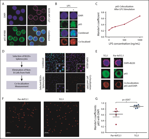 Figure 6. Par-4 downregulates p65-mediated NF-κB signaling. (A) Whole splenocytes from 3- to 4-month-old WT mice mounted, fixed, and stained with anti-B220-APC-Cy7, DAPI, rabbit anti-p6,5 and anti-rabbit-AF488 secondary after stimulation with LPS. (B) Representative images of single, B220+ cells measured for colocalization of AF488-labeled p65 with DAPI stain with and without LPS stimulation. (C) Colocalization of AF488 and DAPI stains, digitally quantified by Imaris imaging software using the Manders coefficient, was shown to increase in a dose-dependent manner after LPS stimulation. (D) Whole splenocytes from 3- to 4-month-old TCL1 and Par-4 × TCL1 mice were mounted, fixed, and stained with anti-B220-APC-Cy7, DAPI, rabbit anti-p65 and anti-rabbit-AF488 secondary. Cells selected by B220 positivity were measured for colocalization of p65 signal with DAPI stain to determine nuclear localization of p65. (E) Representative images of single B220+ cells from both genotypes measured for colocalization of AF488-labeled p65 with DAPI stain. (F) Representative colocalization images of single 60× fields containing 60 cells from TCL1 and Par-4 × TCL1 mice showing less p65 colocalization with DAPI stain in Par-4 × TCL1 mice. (G) Quantification of colocalization by Imaris imaging software through use of the Manders coefficient (P = .0267, n = 5). Results were tested for significance in an unpaired Student t test with α set to 0.05. Original magnification ×60 for panels A-B,D-F.