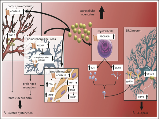Figure 2. Excess extracellular adenosine signaling via ADORA2B receptor contributes to priapism, penile fibrosis, and pain in SCD mice. (A) Excess extracellular adenosine activates ADORA2B receptor in corpus cavernosum and smooth muscle relaxation, contributing to penile fibrosis and priapism, respectively, in SCD. (B) Excess extracellular adenosine activates ADORA2B receptor to induce secretion of IL-6 and sIL-6R from myeloid cells. IL-6 and sIL-6R form a complex that can transactivate gp130 in DRG neurons. gp130 activation leads to activation of phosphorylated STAT3 (pSTAT3), which, in turn, increases TRPV1 gene expression in DRG neurons and overall nociception in SCD mice. ADORA2B–IL-6–sIL-6–gp130 signaling networks are innovative therapeutic targets for priapism and chronic pain. cGMP, guanosine 3′,5′-cyclic monophosphate; PDE, phosphodiesterase.