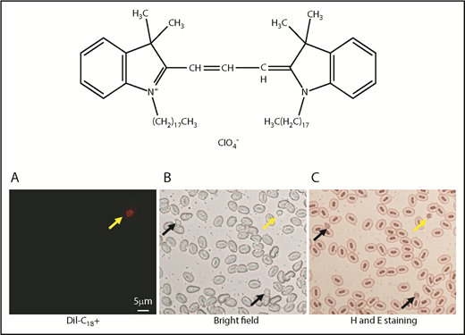 Figure 1. DiI labeling of thrombocytes. Chemical structure of DiI (top). Bottom panels show red fluorescence (A), cells under bright field (B), and hematoxylin and eosin (H and E)–stained blood cells (C). Yellow and black arrows show DP and DN thrombocytes, respectively. DiI-labeled thrombocytes have red fluorescence.